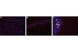 Expression of B1 bradykinin receptor in rat CNS - Immunohistochemical staining of frozen rat brain section (A & B) and cerebellum (C) using Anti-B1 Bradykinin Receptor (BDKRB1) Antibody (ABIN7042967, ABIN7043940 and ABIN7043941), (1:50). (BDKRB1 抗体  (Cys250Ser-Mutant))