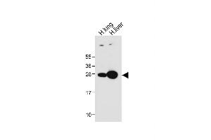 All lanes : Anti-GSTM4 Antibody (N-term) at 1:1000 dilution Lane 1: Human lung tissue lysate Lane 2: Human liver tissue lysate Lysates/proteins at 20 μg per lane. (GSTM4 抗体  (N-Term))