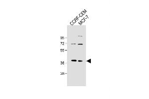 All lanes : Anti-OGN Antibody (N-term K75) at 1:500 dilution Lane 1: CCRF-CEM whole cell lysate Lane 2: MCF-7 whole cell lysate Lysates/proteins at 20 μg per lane. (OGN 抗体  (C-Term))