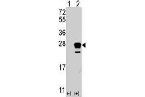 Western blot analysis of NRAS (arrow) using rabbit NRAS polyclonal antibody . (GTPase NRas 抗体  (N-Term))