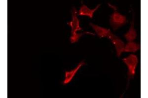 ABIN6275944 staining HeLa by IF/ICC. (FZD1 抗体  (N-Term))