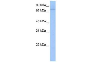 Western Blot showing ZNF440 antibody used at a concentration of 1-2 ug/ml to detect its target protein. (ZNF440 抗体  (C-Term))