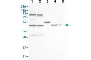 Western blot analysis of Lane 1: RT-4, Lane 2: U-251 MG, Lane 3: Human Plasma, Lane 4: Liver, Lane 5: Tonsil with VPS37A polyclonal antibody  at 1:250-1:500 dilution. (VPS37A 抗体)