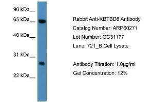 WB Suggested Anti-KBTBD8  Antibody Titration: 0. (KBTBD8 抗体  (N-Term))