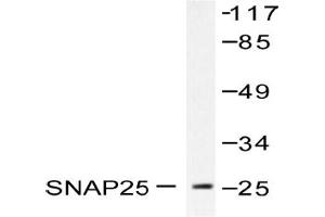 Image no. 1 for anti-Synaptosomal-Associated Protein, 25kDa (SNAP25) antibody (ABIN271818) (SNAP25 抗体)