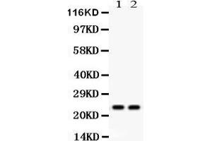 Observed bind size: 22KD (Lipocalin 2 抗体  (AA 21-198))
