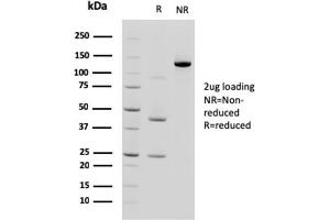 SDS-PAGE AnalysisPurified Cadherin 17 / CDH17 Mouse Monoclonal Antibody (CDH17/2618). (LI Cadherin 抗体  (AA 242-418))