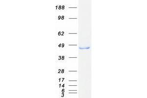Western Blotting (WB) image for 3-hydroxyisobutyryl-CoA Hydrolase (HIBCH) (Transcript Variant 1) protein (Myc-DYKDDDDK Tag) (ABIN2722721)