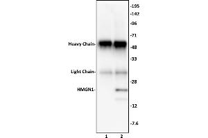 HMGN1 antibody (pAb) tested by Immunoprecipitation. (HMGN1 抗体  (C-Term))