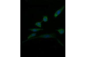 Image no. 2 for anti-D-Dopachrome Tautomerase (DDT) antibody (ABIN1497794) (DDT 抗体)