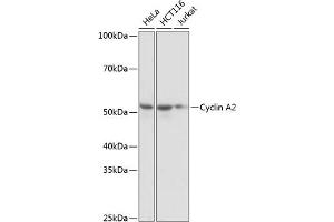 Western blot analysis of extracts of various cell lines, using Cyclin  antibody (ABIN7266551) at 1:1000 dilution. (Cyclin A 抗体)