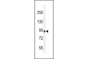 IL12RB2 Antibody (C-term) (ABIN654644 and ABIN2844340) western blot analysis in MDA-M cell line lysates (35 μg/lane). (IL12_2 (AA 756-783), (C-Term) 抗体)