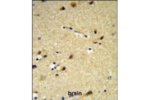 Immunohistochemistry (Paraffin-embedded Sections) (IHC (p)) image for anti-Cytochrome P450, Family 26, Subfamily A, Polypeptide 1 (CYP26A1) (AA 467-497), (C-Term) antibody (ABIN650717)