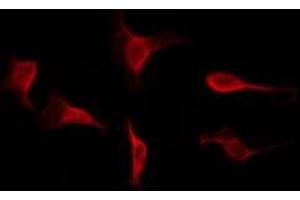 ABIN6268808 staining HeLa by IF/ICC.