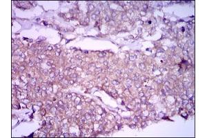 Image no. 2 for anti-Glypican 3 (GPC3) (AA 55-200) antibody (ABIN1498500) (Glypican 3 抗体  (AA 55-200))