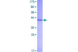 Image no. 1 for Interferon, alpha 1 (IFNA1) (AA 1-189) protein (GST tag) (ABIN1307448)