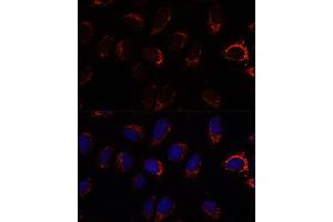 Immunofluorescence analysis of U-2 OS cells using S2 antibody (ABIN7265451) at dilution of 1:100. (AP3S2 抗体  (AA 1-193))