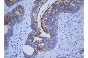 Image no. 2 for anti-Keratin 20 (KRT20) (AA 1-266) antibody (ABIN1490690) (KRT20 抗体  (AA 1-266))