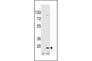 Western blot analysis of UBE2H (arrow) using rabbit polyclonal UBE2H Antibody  (ABIN650698 and ABIN2839162). (UBE2H 抗体  (C-Term))