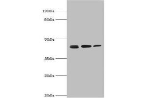 Western blot All lanes: Actin-related protein 2 antibody at 3 μg/mL Lane 1: Mouse spleen tissue Lane 2: Jurkat whole cell lysate Lane 3: MCF-7 whole cell lysate Secondary Goat polyclonal to rabbit IgG at 1/10000 dilution Predicted band size: 45, 46 kDa Observed band size: 45 kDa (ACTR2 抗体  (AA 1-160))