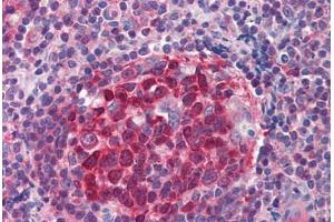 Human Tonsil (formalin-fixed, paraffin-embedded) stained with RRM2B antibody ABIN214469 at 2. (RRM2B 抗体  (AA 2-17))