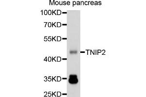Western blot analysis of extracts of mouse pancreas, using TNIP2 antibody (ABIN1875145) at 1:1000 dilution. (TNIP2 抗体)