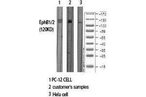 Western Blot (WB) analysis of specific cells using EphB1/2 Polyclonal Antibody. (EPHB1/2 抗体  (Ser10))