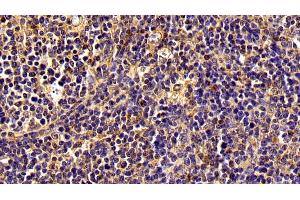 Immunohistochemistry (IHC) image for anti-Nuclear Factor kappa B (NFkB) (AA 42-367) antibody (ABIN7434137)