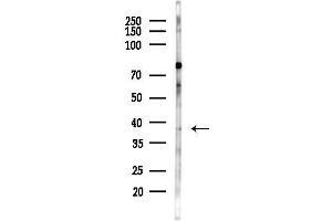 Western blot analysis of lysates from HepG2 cells(starvation,24h treatment), using CPOX Antibody at 1/1000 dilution.