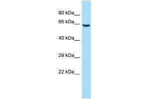 Host: Rabbit Target Name: CDADC1 Sample Type: 293T Whole Cell lysates Antibody Dilution: 1. (CDADC1 抗体  (C-Term))