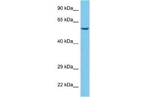 Host:  Rabbit  Target Name:  SLCO1A2  Sample Tissue:  Human Hela Whole Cell  Antibody Dilution:  1ug/ml (SLCO1A2 抗体  (Middle Region))