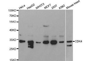 Western blot analysis of extracts of various cell lines, using CDK4 antibody. (CDK4 抗体  (AA 1-303))