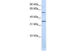 WB Suggested Anti-TJAP1 Antibody Titration:  0. (TJAP1 抗体  (C-Term))