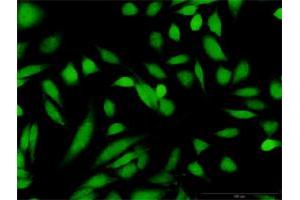 Immunofluorescence (IF) image for anti-Glucokinase (Hexokinase 4) (GCK) (AA 1-465) antibody (ABIN515989)