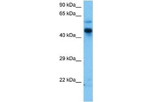 Host:  Mouse  Target Name:  ZIC3  Sample Tissue:  Mouse Brain  Antibody Dilution:  1ug/ml (ZIC3 抗体  (N-Term))