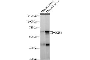 Western blot analysis of extracts of various cell lines, using IKZF3 antibody (ABIN7267842) at 1:500 dilution. (IKZF3 抗体)