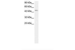Image no. 1 for anti-Chemokine (C-C Motif) Receptor 8 (CCR8) (AA 163-212) antibody (ABIN202331) (CCR8 抗体  (AA 163-212))