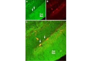 Immunohistochemistry (IHC) image for anti-Glutamate Receptor, Ionotropic, N-Methyl D-Aspartate 2a (GRIN2A) (AA 41-53), (Extracellular) antibody (ABIN7043228)