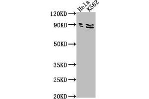 Western Blot Positive WB detected in: Hela whole cell lysate, K562 whole cell lysate All lanes: SUPV3L1 antibody at 1:2000 Secondary Goat polyclonal to rabbit IgG at 1/50000 dilution Predicted band size: 88 kDa Observed band size: 88 kDa (SUPV3L1 抗体  (AA 499-786))