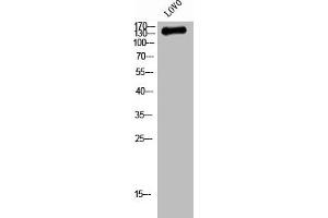 Western Blot analysis of LOVO cells using QSK Polyclonal Antibody (SIK3 抗体  (Internal Region))