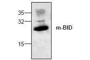 Image no. 1 for anti-BH3 Interacting Domain Death Agonist (BID) antibody (ABIN127071) (BID 抗体)