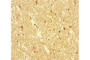 Immunohistochemistry of paraffin-embedded human brain tissue using ABIN7149587 at dilution of 1:100 (DOCK3 抗体  (AA 1630-1934))