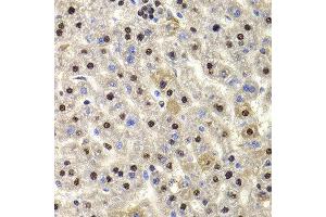 Immunohistochemistry of paraffin-embedded rat liver using HIRIP3 antibody at dilution of 1:100 (x400 lens). (HIRIP3 抗体)