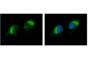 ICC/IF Image Ribonuclease A antibody detects RNASE1 protein at cytoplasm by immunofluorescent analysis. (RNASE1 抗体  (Center))