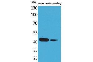 Western Blotting (WB) image for anti-Actin, Alpha, Cardiac Muscle 1 (ACTC1) (N-Term) antibody (ABIN3180981) (ACTC1 抗体  (N-Term))