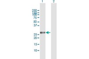Western Blot analysis of AK3 expression in transfected 293T cell line by AK3 MaxPab polyclonal antibody. (Adenylate Kinase 3 抗体  (AA 1-227))