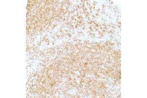 Immunohistochemistry (IHC) image for anti-CD22 Molecule (CD22) (AA 20-687) antibody (ABIN7453999) (Recombinant CD22 抗体  (AA 20-687))