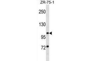 Western Blotting (WB) image for anti-Tubulin Tyrosine Ligase-Like Family, Member 8 (TTLL8) antibody (ABIN2999022)