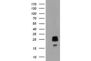 Western Blotting (WB) image for anti-ClpP Caseinolytic Peptidase, ATP-Dependent, Proteolytic Subunit Homolog (E. Coli) (CLPP) antibody (ABIN1497537) (CLPP 抗体)