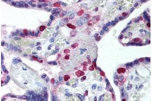 Human Placenta (formalin-fixed, paraffin-embedded) stained with PCNA antibody ABIN239835 at 10 ug/ml followed by biotinylated anti-mouse IgG secondary antibody ABIN481714, alkaline phosphatase-streptavidin and chromogen. (PCNA 抗体)
